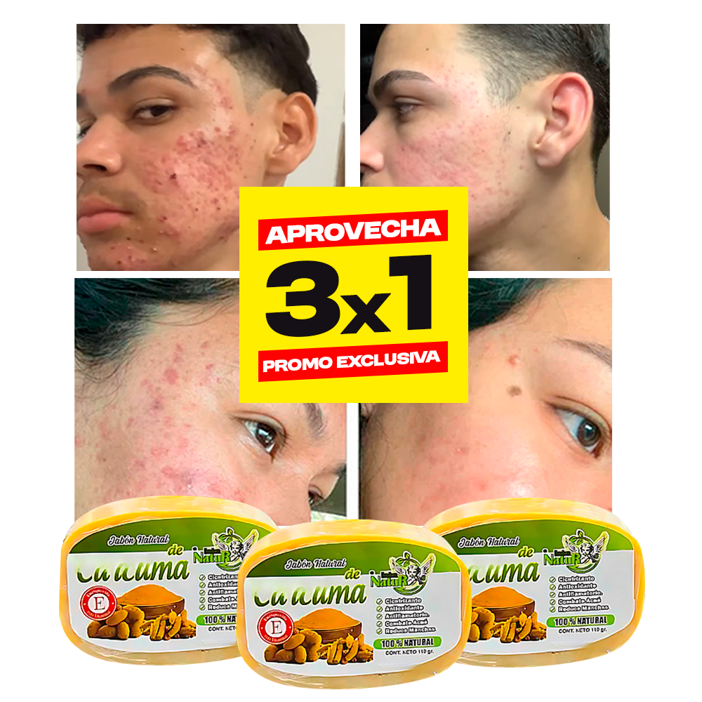 COMPRA 1, LLÉVATE3 🎁 ¡TU PIEL TE LO AGRADECERÁ! ⏳