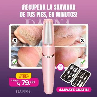 DannaGlow™ | Removedor de callos eléctrico